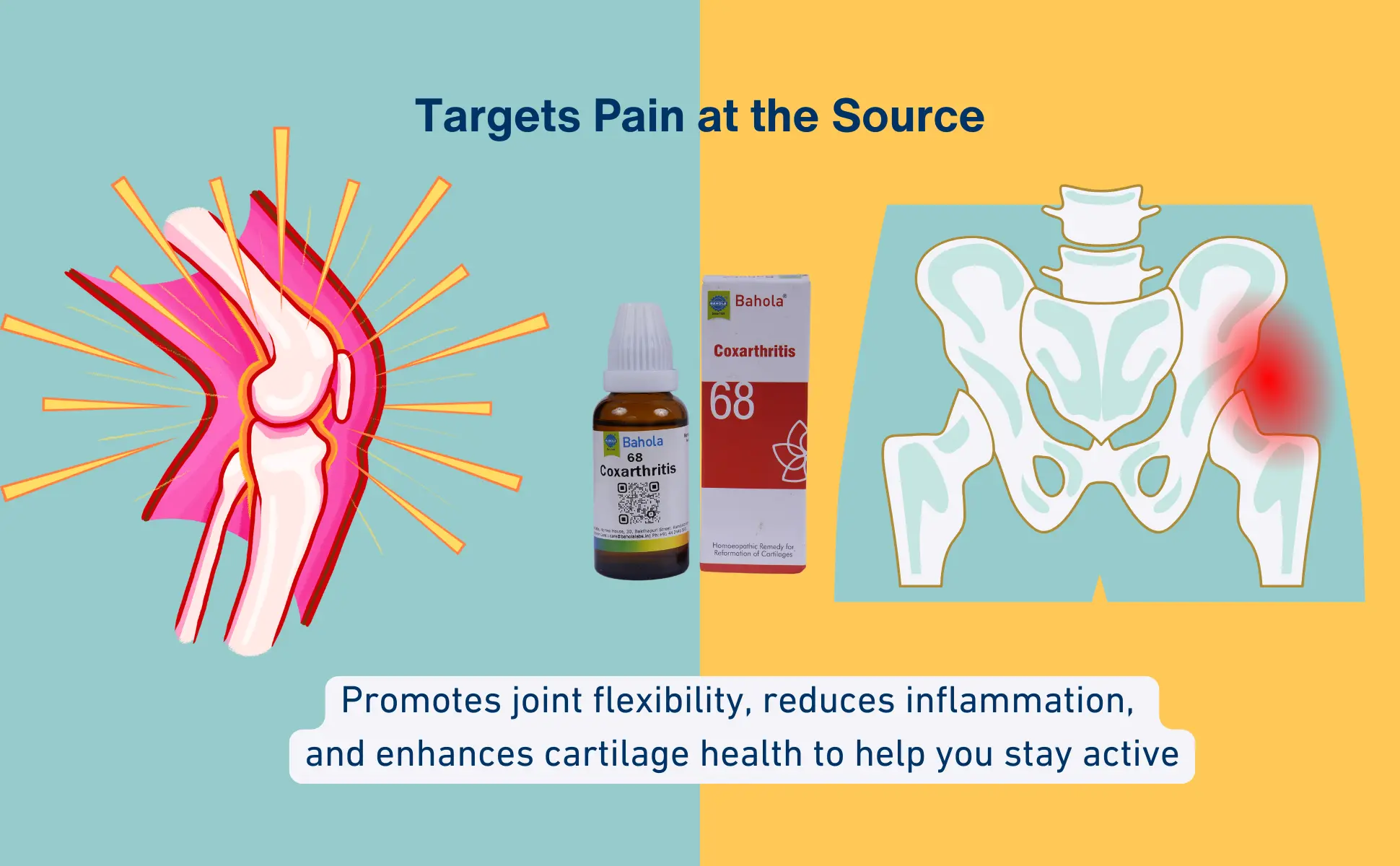 Coxarthritis 8 Address joint pain