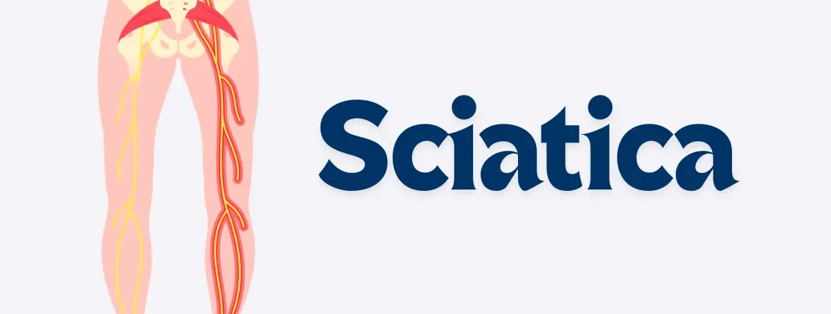 Sciatica