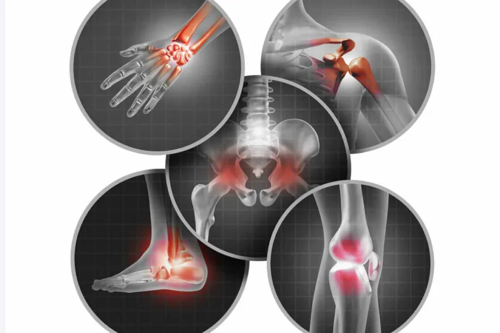 Cartilage wear and tear