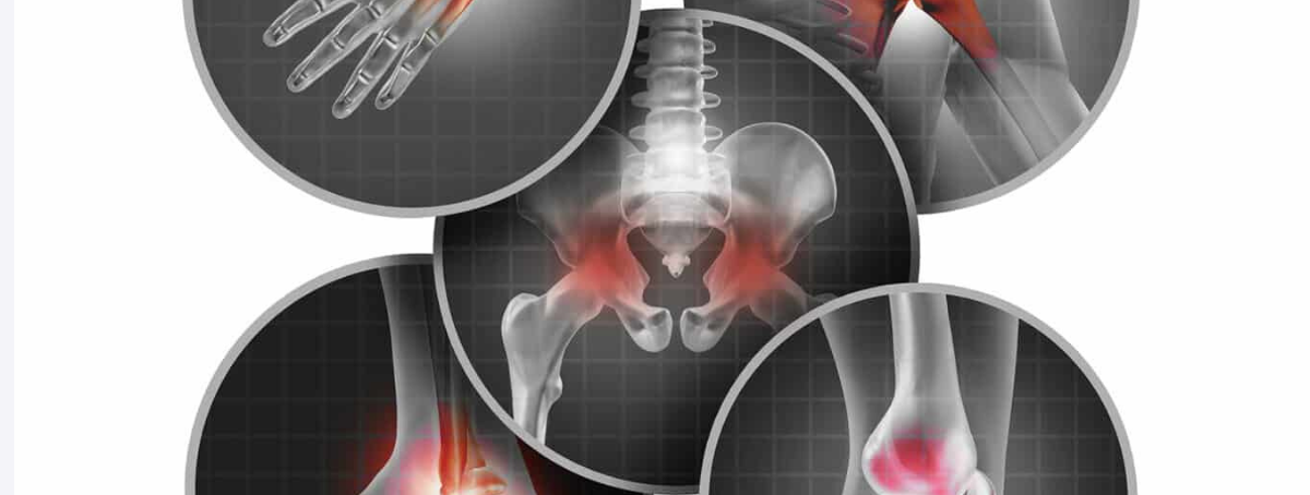 Cartilage wear and tear